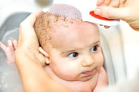 How to Treat Cradle Cap at Home?