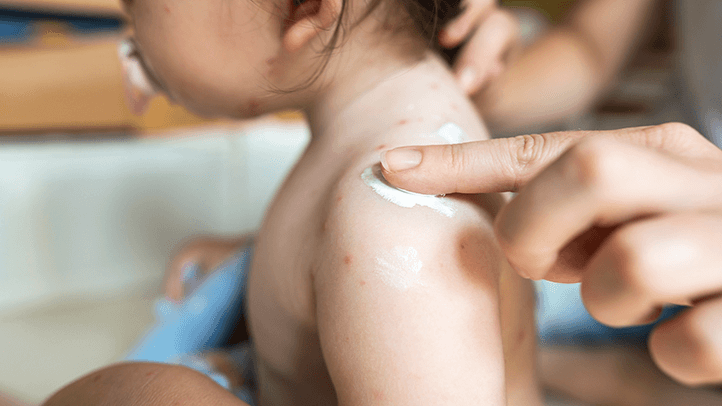 5 Common Baby Skin Care Issues and What to Do About Them