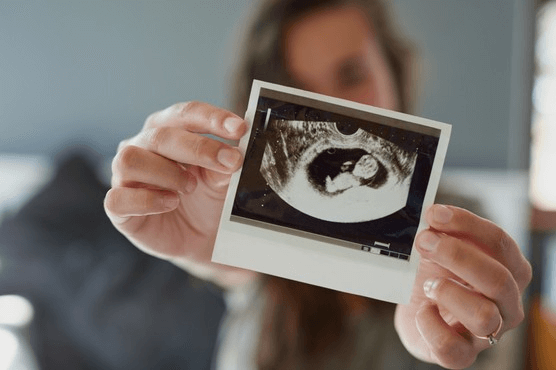 How Accurate is an Ultrasound at Predicting Your Baby’s Gender