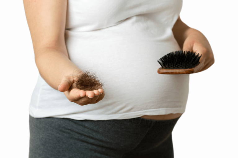 Understanding Hair Loss During Pregnancy