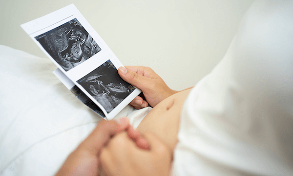 Late Miscarriage: Causes, Symptoms, and Support