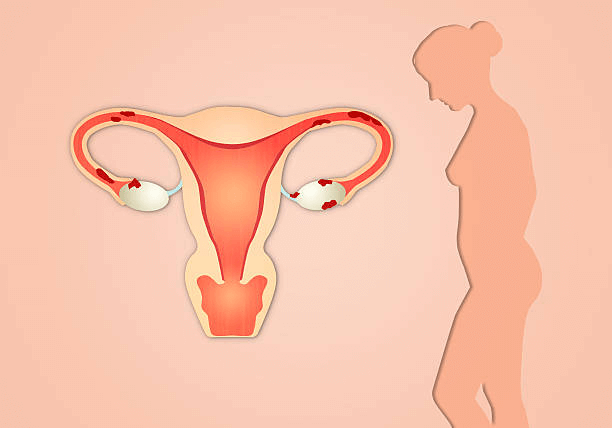 Uterine Abnormalities During Pregnancy